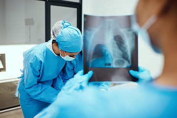 Image showing Xray, body and surgery team in hospital, consulting for cancer tumor healthcare wellness or emergency risk. Nurse, doctor and medical worker for consultation, anatomy research and patient injury