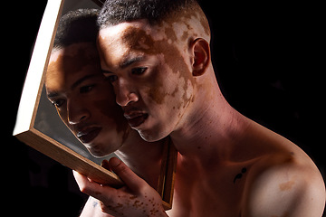 Image showing Vitiligo, beauty and mirror for man reflection of skin condition, disorder or problem with dermatology treatment on black studio background. Pigmentation, patches and melanin of male face for art