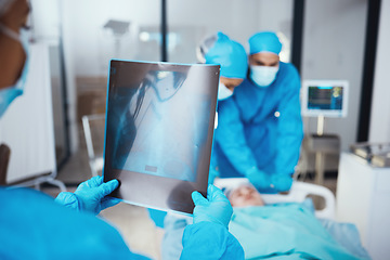 Image showing Team of doctors, x ray and surgery in hospital with patient in stretcher. Teamwork, healthcare and medical professional with mammogram, nurses and surgeons preparing for operation of person in clinic