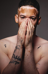 Image showing Skincare, beauty and black man with vitiligo, body health and cosmetic portrait on a dark background. Hand, cover and face of a model for wellness, care of skin and dermatology on a studio background