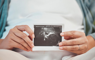 Image showing Pregnancy, love and hands with scan of baby with woman excited for future with family, children and kids. Healthcare, newborn baby and hand of pregnant woman with 3d image, ultrasound and photograph