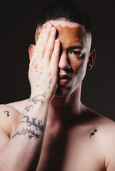 Image showing Man, vitiligo and beauty with hand, face and skincare portrait, dermatology and aesthetic in black studio background. Young male, model and skin pigmentation and body melanin with health in mockup