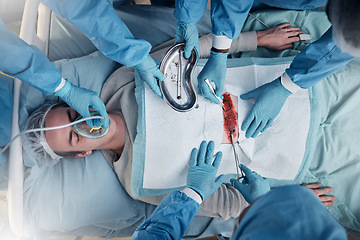 Image showing Doctors, surgery and collaboration with a medicine team in scrubs operating on a man patient in a hospital. Doctor, nurse and teamwork with a medical group in a clinic to perform an operation