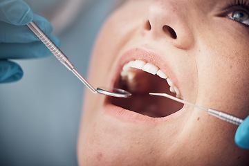 Image showing Teeth, dental or woman at a dentist for surgery, teeth whitening or mouth cleaning for gum disease bacteria. Wellness, tooth decay or hands helping or working with oral tools in healthcare clinic