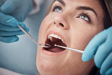 Image showing Teeth, dental or woman at a dentist for surgery, teeth whitening or mouth cleaning for gum disease bacteria. Wellness, tooth decay or hands helping or working with oral tools in healthcare clinic