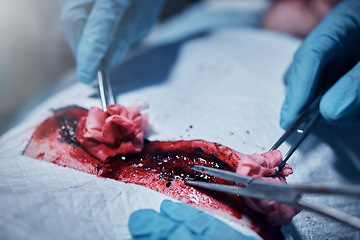 Image showing Hands, blood and operation with a team of doctors at work during surgery with equipment or a tool in a hospital. Doctor, nurse and collaboration with a medicine professional group saving a life