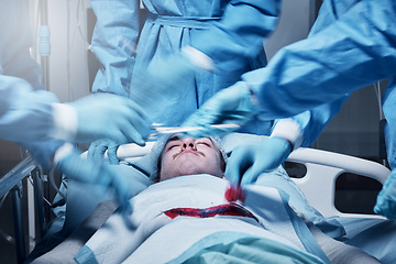 Image showing Surgery team, doctor and blood in medical hospital room for healthcare wellness, heart theater and patient emergency. Nurses hands, clinic teamwork and surgical operation or cardiology surgeon