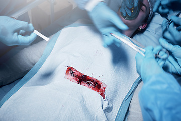 Image showing Hands, blood and operation with a team of doctors at work during surgery with equipment or a tool in a hospital. Doctor, nurse and collaboration with a medicine professional group saving a life