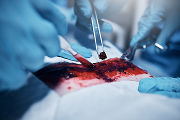 Image showing Hands, blood and operation with a team of doctors at work during surgery with equipment or a tool in a hospital. Doctor, nurse and collaboration with a medicine professional group saving a life