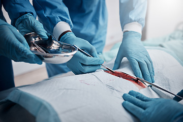 Image showing Doctors, nurses or surgery hands on cut patient in hospital emergency room for stomach ulcer, heart attack or burst appendix. Zoom, healthcare workers or surgical operation and steel metal equipment