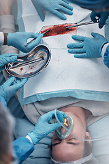 Image showing Doctors, surgery and blood with a medicine team in scrubs operating on a man patient in a hospital. Doctor, nurse and teamwork with a medical group in a clinic to perform an operation