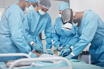 Image showing Doctors, surgery and collaboration with a medicine team in scrubs operating on a man patient in a hospital. Doctor, nurse and teamwork with a medical group in a clinic to perform an operation