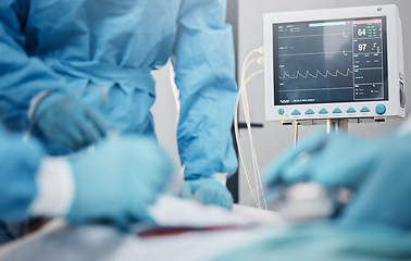 Image showing Hands, monitor and operation with a team of doctors at work during surgery with equipment or a tool in a hospital. Doctor, nurse and collaboration with a medicine professional group saving a life