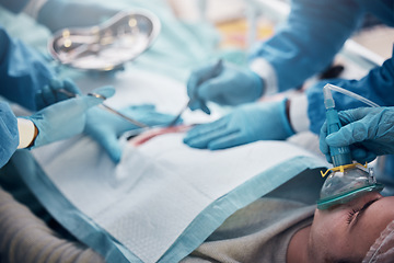 Image showing Doctors, nurses or surgery hands on cut patient in hospital emergency room for stomach ulcer or burst appendix. Zoom, healthcare workers or surgical operation and steel metal equipment