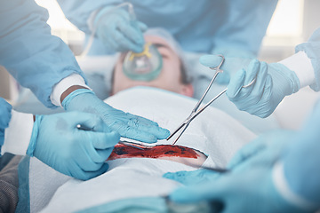 Image showing Hands, blood and operation with a team of doctors at work during surgery with equipment or a tool in a hospital. Doctor, nurse and collaboration with a medicine professional group saving a life