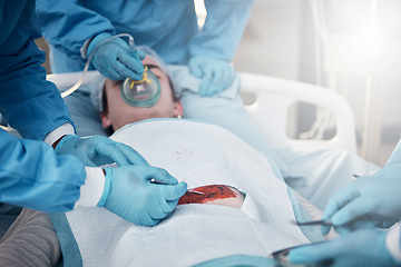 Image showing Doctors, surgery and blood with a medicine team in scrubs operating on a man patient in a hospital. Doctor, nurse and teamwork with a medical group in a clinic to perform an operation