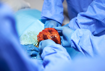 Image showing Organ transplant, surgery and doctors with heart in hospital for medical service, procedure and operation. Healthcare, teamwork and hands in theater for donation from injury, accident and emergency