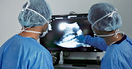 Image showing Back, surgery, x ray and a team of doctors in the hospital for an operation or procedure to remove a tumor. Healthcare, medical planning and a surgeon looking at a screen with a medicine professional