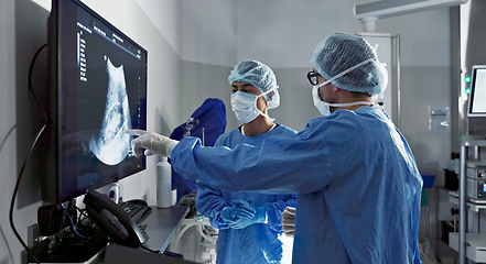 Image showing Surgery, x ray and a team of doctors in the hospital for an operation or procedure to remove a tumor. Healthcare, medical teamwork and a surgeon looking at a screen with a medicine professional
