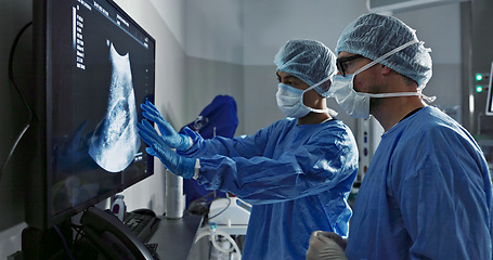 Image showing Surgery, x ray and a team of doctors in the hospital for an operation or procedure to remove a tumor. Healthcare, medical teamwork and a surgeon looking at a screen with a medicine professional