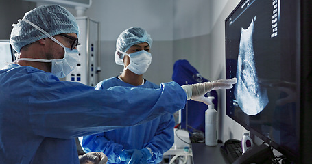 Image showing Surgery, x ray and a team of doctors in the hospital for an operation or procedure to remove a tumor. Healthcare, medical teamwork and a surgeon looking at a screen with a medicine professional