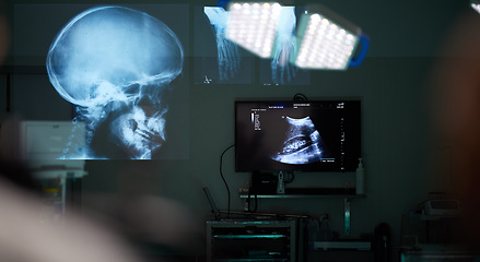 Image showing Surgery room, xray and skull with healthcare, neuroscience and medicare with diagnosis. Holographic, medical treatment and skeleton with monitor, digital and brain with research, scan and anatomy