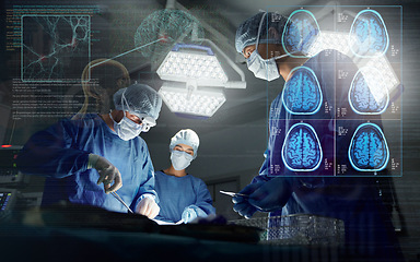 Image showing Surgery, team and overlay neurology working research operation or hospital theater, confident or patient trust. Male person, hands and professional tools for brain anatomy, skull or medical doctors