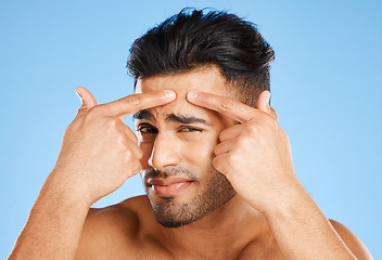 Image showing Skincare, confused and portrait of acne man with hands on face feeling pimple with anxiety, doubt and stress. Model in studio analyzing skin with facial aesthetic problem on blue background.