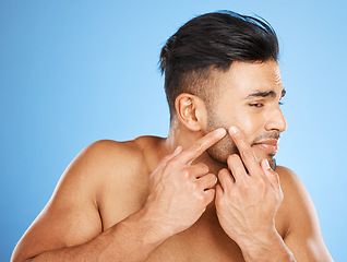 Image showing Health, skincare and man popping acne in face with blue background. Mens skin care, morning facial and young guy with flaws, blemish and imperfection pop pimple or blackhead with fingers and hands.