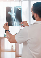 Image showing Man, physiotherapist and x ray scan analysis in sports clinic for broken bone check, healthcare wellness or knee injury surgery planning. Medical worker, xray image or test results for physiotherapy