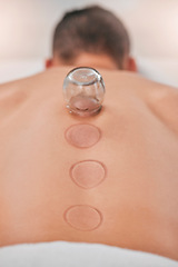 Image showing Wellness, man and cupping massage at spa for relief in stress, inflammation and back pain, healthcare and relax. Cupping therapy, back and guy in resort for alternative therapy, acupuncture and rest