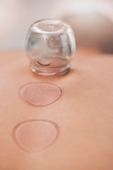 Image showing Spa, wellness and person with suction treatment on back for pain, pressure and tension relief in body. Healthcare, luxury and close up of cupping as natural medicine and traditional cure for stress