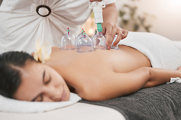 Image showing Relax, health and cupping with woman in spa for alternative medicine, healing and physiotherapy. Peace, wellness and consulting with patient and hands of massage therapist for zen, holistic or muscle
