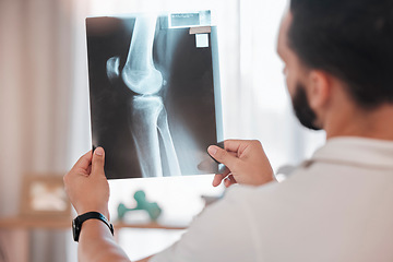 Image showing Health, x ray and physiotherapy, man physiotherapist check medical results from injury, broken bone and healthcare. Physio, wellness and medicine, rehabilitation in health care and xray scan.