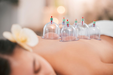 Image showing Cupping therapy, spa and zen woman for chinese alternative medicine treatment for back pain and health. Bodycare and wellness with cup therapy for stress relief, wellbeing wiith cups and heat on skin