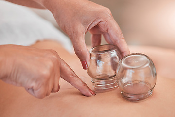 Image showing Cupping, therapy and back massage at a wellness, health and beauty spa at a self care resort. Healing, body care and hands of a therapist doing healthy treatment with vacuum glasses for stress relief