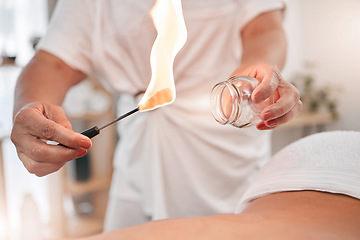Image showing Fire massage, flame and heating for cupping spa therapy for holistic wellness with glass jars. Beauty, luxury skincare and body treatment of a physical therapy session to find relax, peace and health