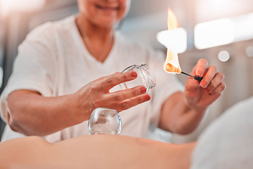 Image showing Woman, hands or flame for cupping therapy in spa, hotel salon or holistic Chinese treatment for pain relief, muscle stress or injury. Zoom, massage therapist or fire in glass cup for wellness healing