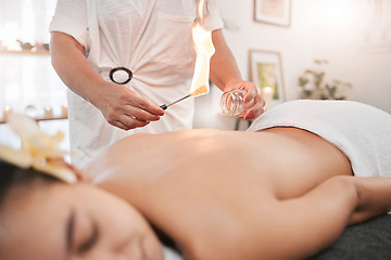 Image showing Relax, luxury and woman in cupping therapy for back pain or muscle injury sleeping in peace for physiotherapy. Fire, heating and girl customer with physiotherapist in physical therapy for healing