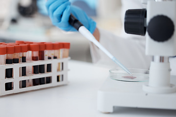 Image showing Hands, pipette and scientist with blood petri dish for research in laboratory. Science, medical professional and doctor with dropper for dna analysis, test and biology experiment to study dna sample.