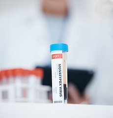 Image showing Blood test, sample of virus and science in laboratory, research and studying monkeypox, infection and viral disease. Medical study, tube and analysis of pathology, biology and immunity in dna