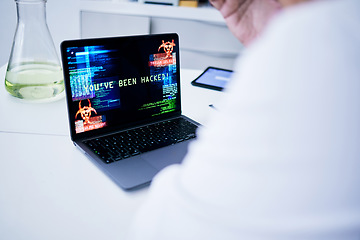 Image showing Hacked, laptop or scientist with cyber security attack, virus problem or 404 glitch in laboratory. Screen, password mistake or medical worker with research trouble, software spam or ransomware danger