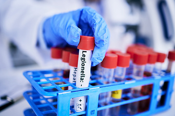 Image showing Scientist, hand and bacteria sample in test tube, person in lab with medical research and healthcare study. Doctor, gloves and vaccine, check legionella sample closeup and scientific experiment