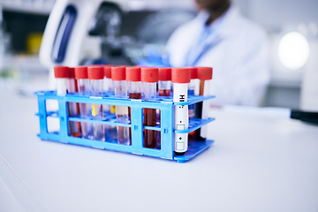 Image showing Medical, research and vials with blood test, science and breakthrough with discovery, experiment and project. Tube, healthcare and laboratory equipment with scientific innovation and chemical liquid