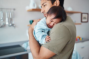 Image showing Crying, down syndrome baby and father holding, comforting and consoling upset child in their home with a caring parent. Asian man or dad showing love for special needs infant girl during family time