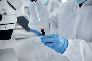 Image showing Hands, scientist and blood pipette test tube for research, sample analysis or dna testing. Medical doctor, laboratory worker or chemist working with chemical dropper for health or disease diagnosis