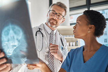 Image showing Brain, x ray and neurology doctors in a meeting working on a skull injury in emergency room in a hospital. Diversity, cancer and healthcare medical neurologist checking mri or xray scan with teamwork