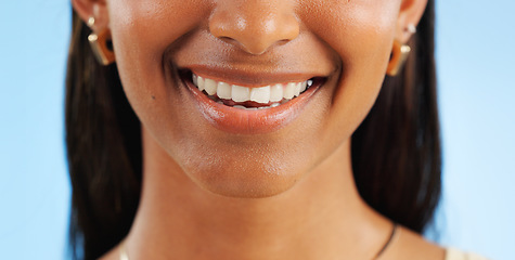 Image showing Teeth whitening, closeup of dental and woman with smile for oral care, wellness and mouth on blue background. Beauty, hygiene and orthodontics with skin, cosmetics and healthy in studio with veneers