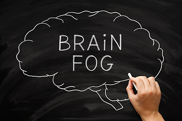 Image showing Brain Fog Concept Drawn On Blackboard