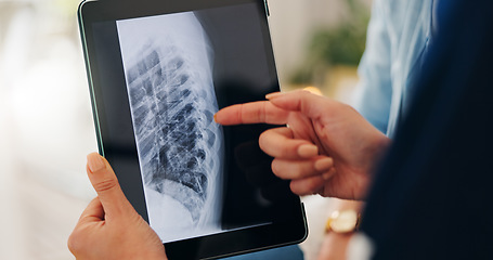 Image showing Healthcare, x ray and tablet for hand in closeup by pointing of injury on screen in consulting. Medical professional, doctor or person for technology of results, diagnosis or bone fracture of patient